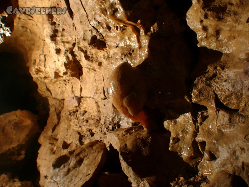 Rostnagelhöhle: Meandersyndrom.